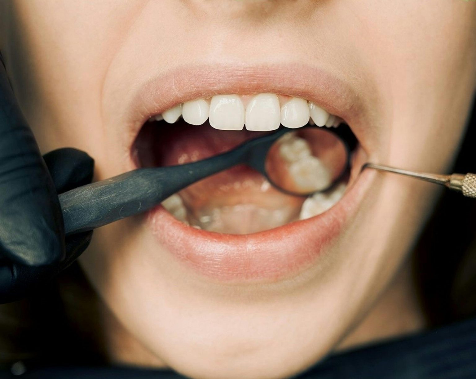 From Fear to Comfort: Tackling Your Dental Phobia