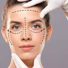 Transform Your Look with a Facelift in Dubai: A Guide to Renewed Confidence facelift